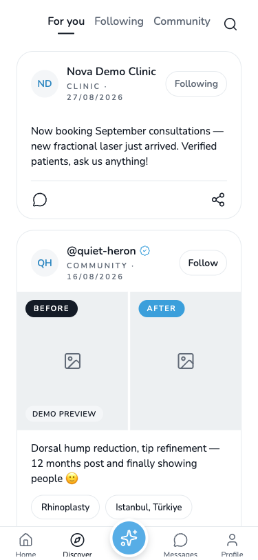 Otheon Discover feed with a clinic update and a community before and after post